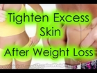 How to Tighten Excess Skin After Weight Loss