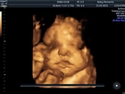 Amazing 4D baby scan  http://www.scan4d.co.uk/ call 08000075076